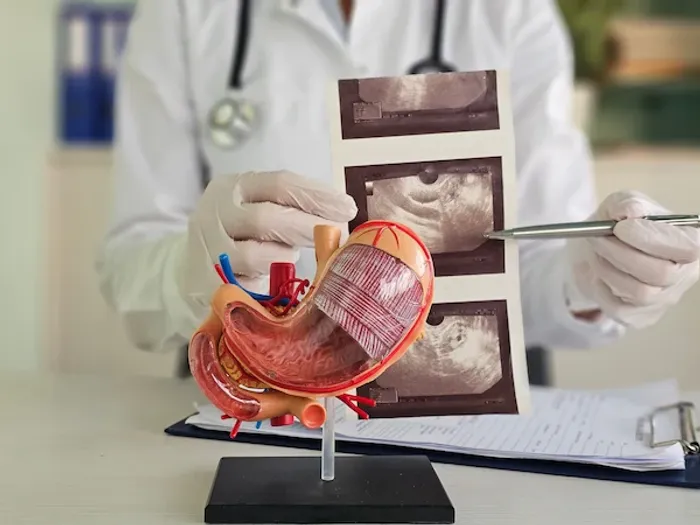 endoscopic ultrasound